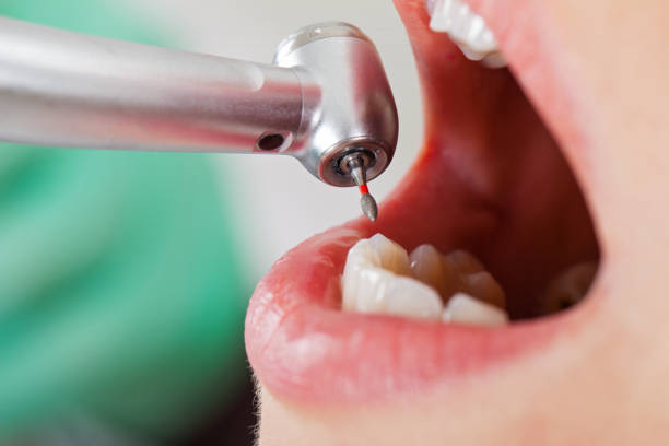 Best Cosmetic Emergency Dentistry in Hicksville, OH